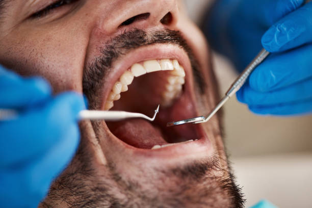 Best Cracked Tooth Emergency Dentist  in Jackson, GA