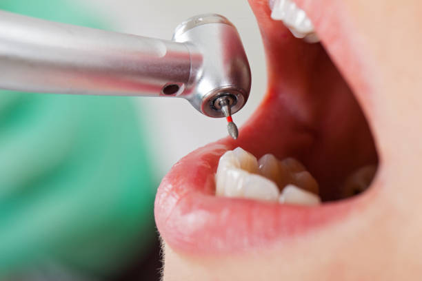 Best Emergency Dentist for Kids  in Jackson, GA